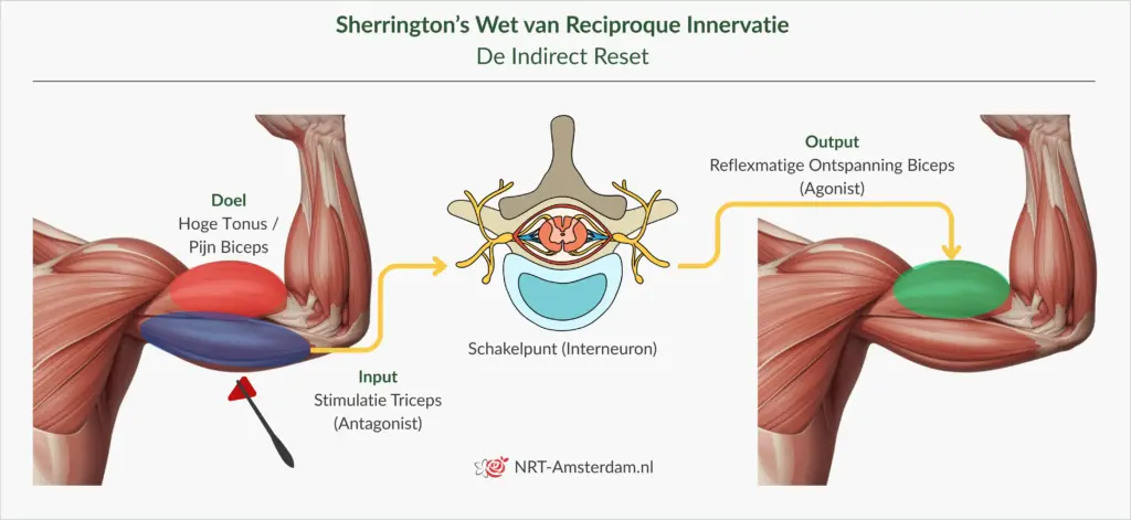 wet-van-sherrington-spierspanning-indirect-reset | NRT-Amsterdam.nl Uitleg van de Wet van Sherrington over reciproke inhibitie en het verlagen van spierspanning via een indirecte reset.